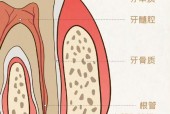 牙周病与脑卒中风险，密切关联的警示标题