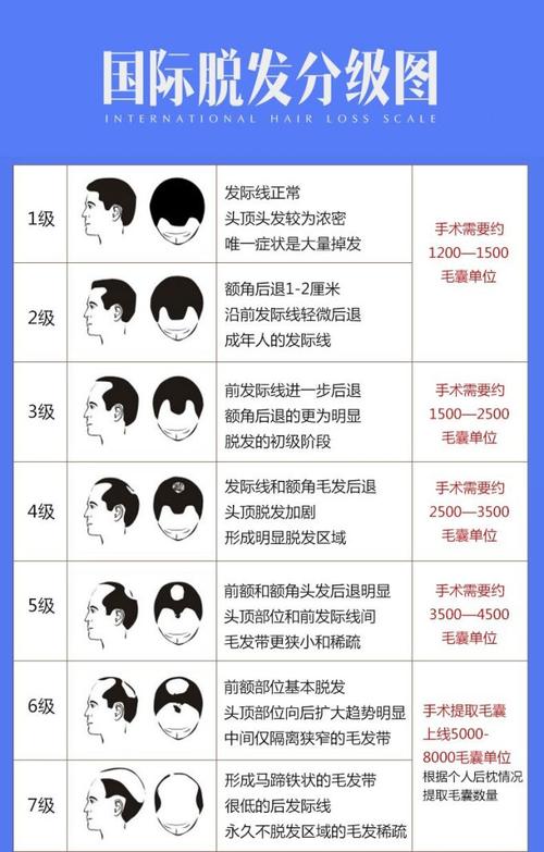 植发一根头发大概要多少钱，植发价位一根  第6张