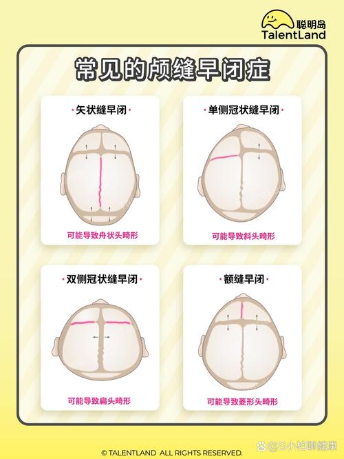 于适，头尖气质独特，展现别样魅力  第3张