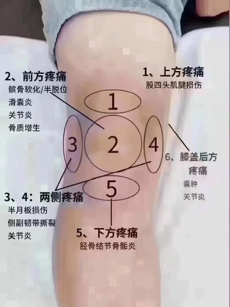 马克龙与特朗普，政治舞台上的膝盖较量  第4张